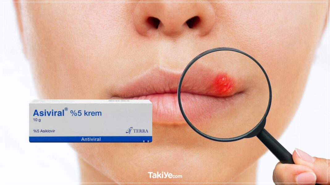 Asiviral Krem Ne İşe Yarar? Nasıl Kullanılır? Asiviral Krem Fiyatı Ne Kadar? Kullananlar Ne Diyor? asiviral krem