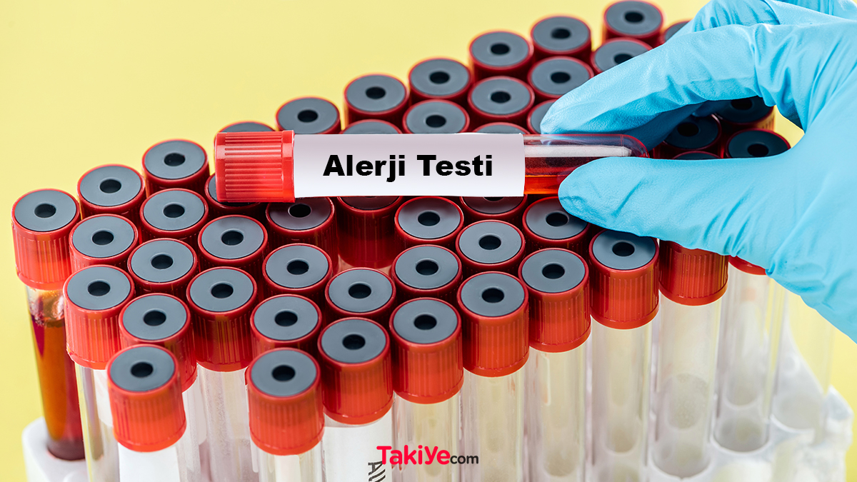 Alerji testi hangi durumlarda yapılamaz?