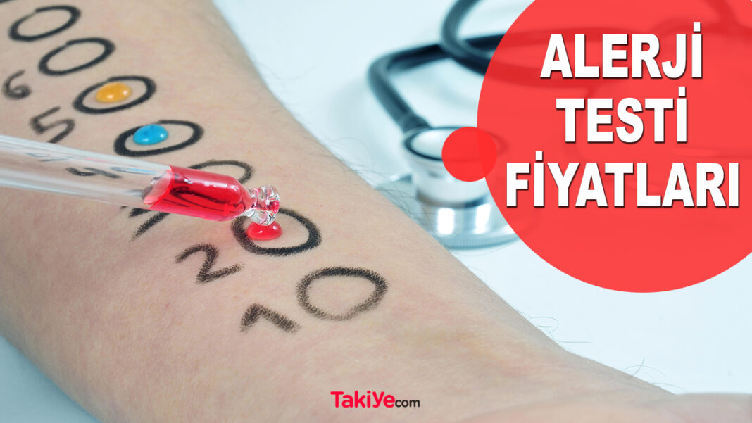 Alerji Testi Fiyatları Ne Kadar? Alerji Testi Yapan Hastaneler Hangileridir? alerji testi fiyatları
