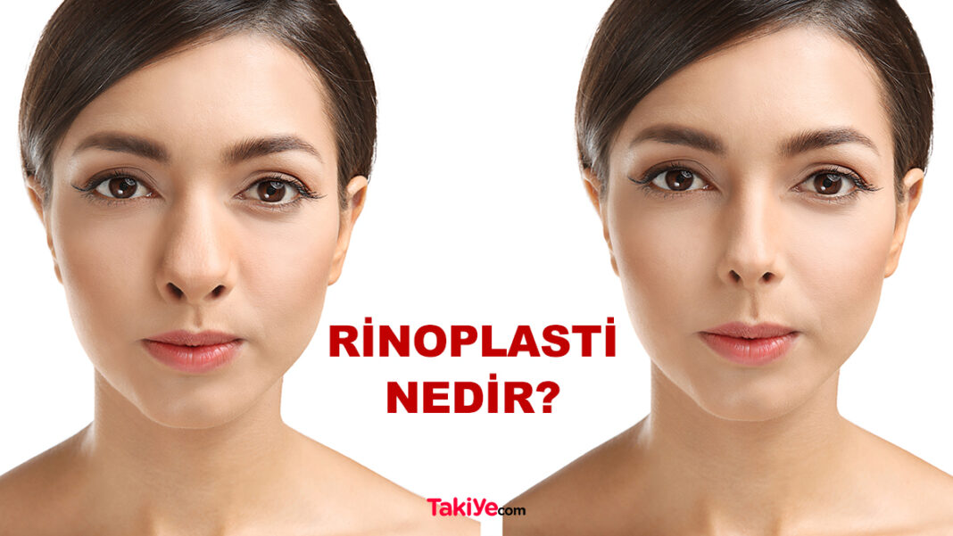 rinoplasti nedir